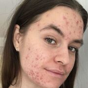 ,  , 18