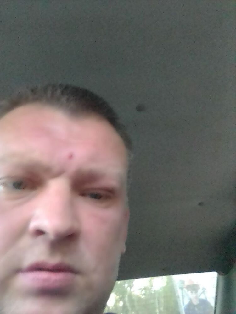  27792199  , 41 ,    