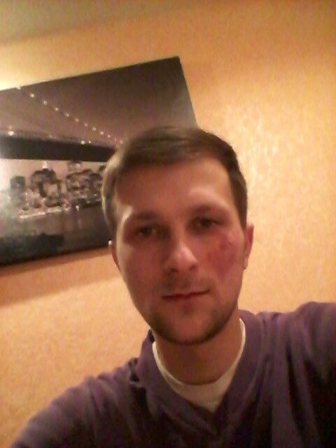 ���������� �����, ���� ������� ����, 35 ���, ������������ ��� ������