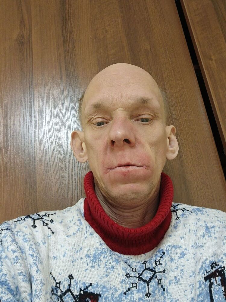 ���������� �����-���������, ���� ������� �������, 46 ���, ������������ ��� c�������� ���������