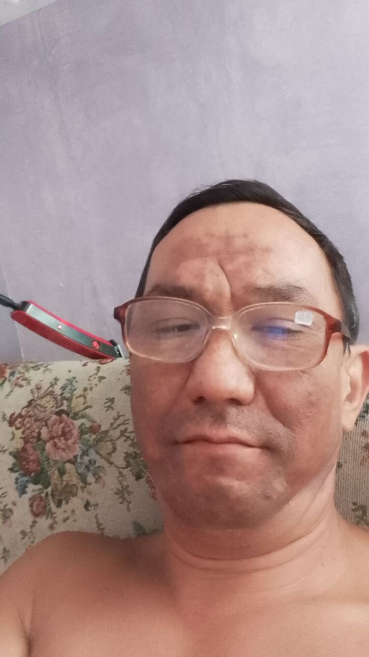  35300669  , 48 ,    