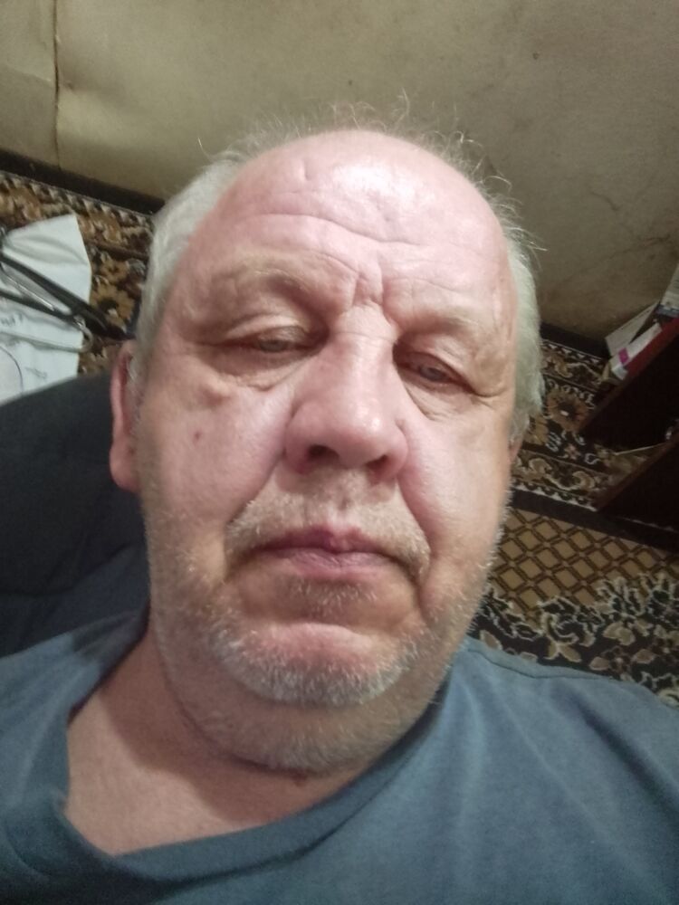  36237339  , 54 ,    
