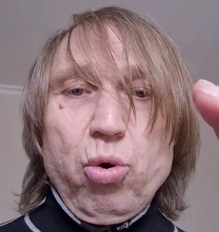  33175309  I__I, 20 ,    