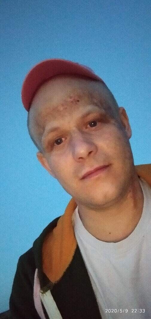  21267699  , 32 ,    