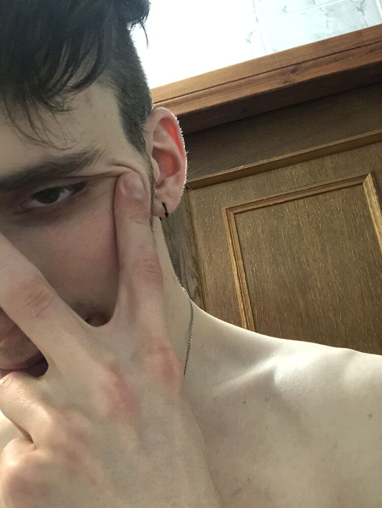  25617509  , 28 ,    