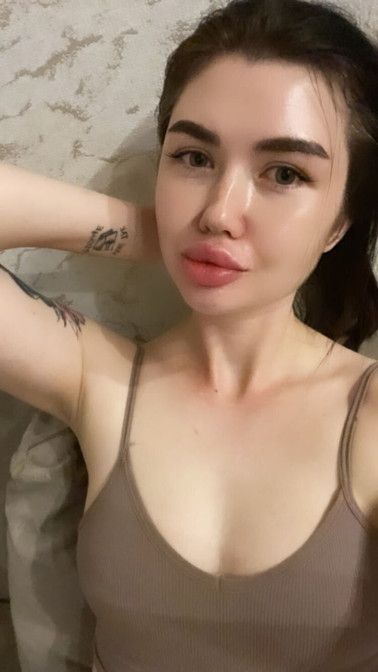  34915749  , 28 ,    