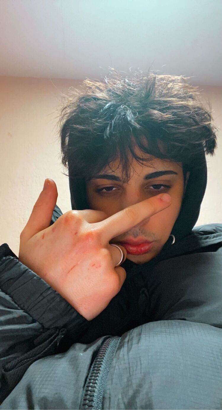 ���������� ������, ���� ����� Alle, 24 ����, ������������ ��� ������, ����� � ���������