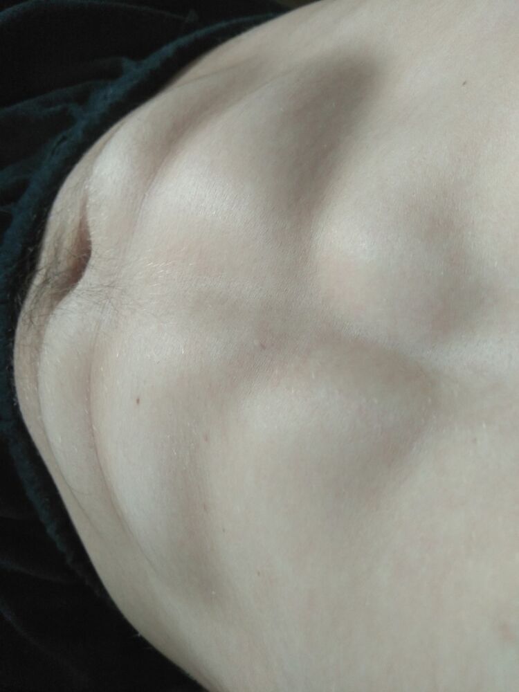  18288229  , 38 ,    