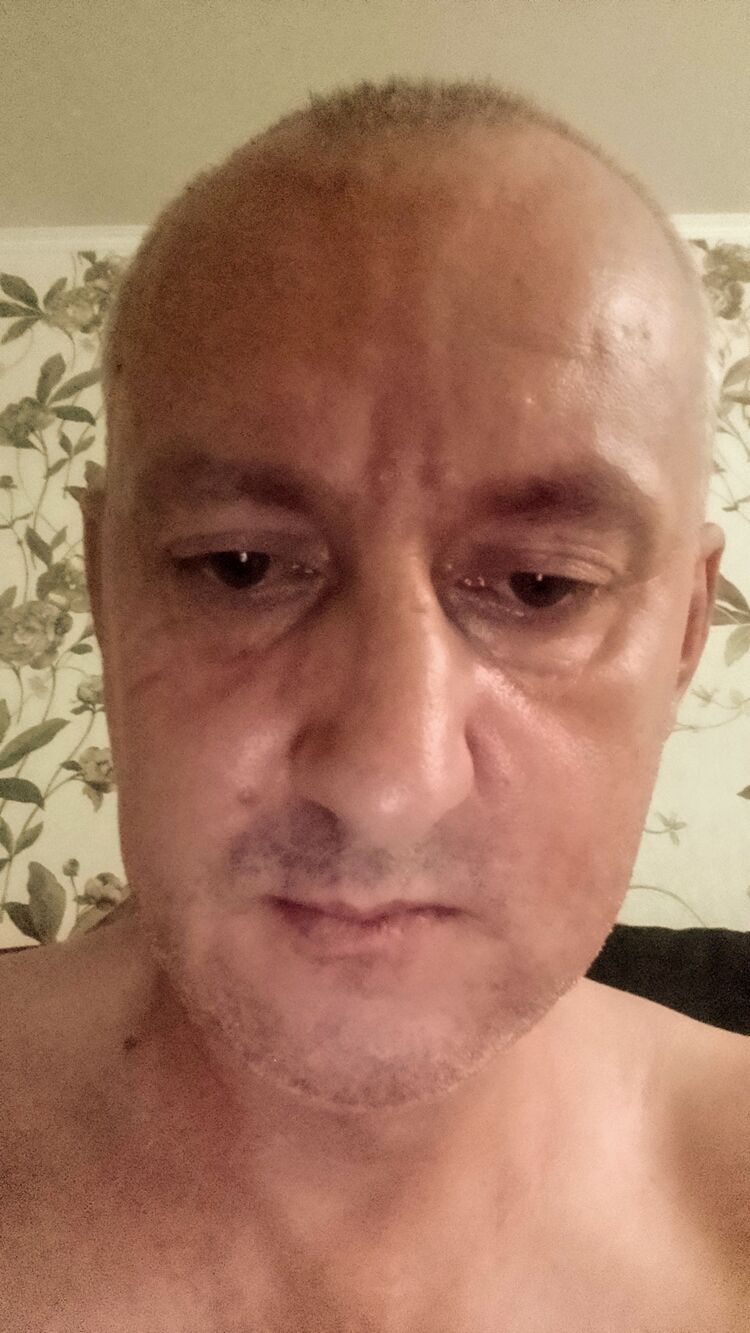  45549179  , 48 ,    
