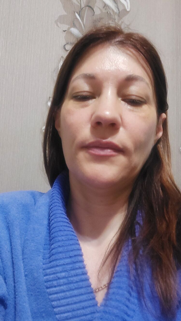  54290289  , 49 ,    --