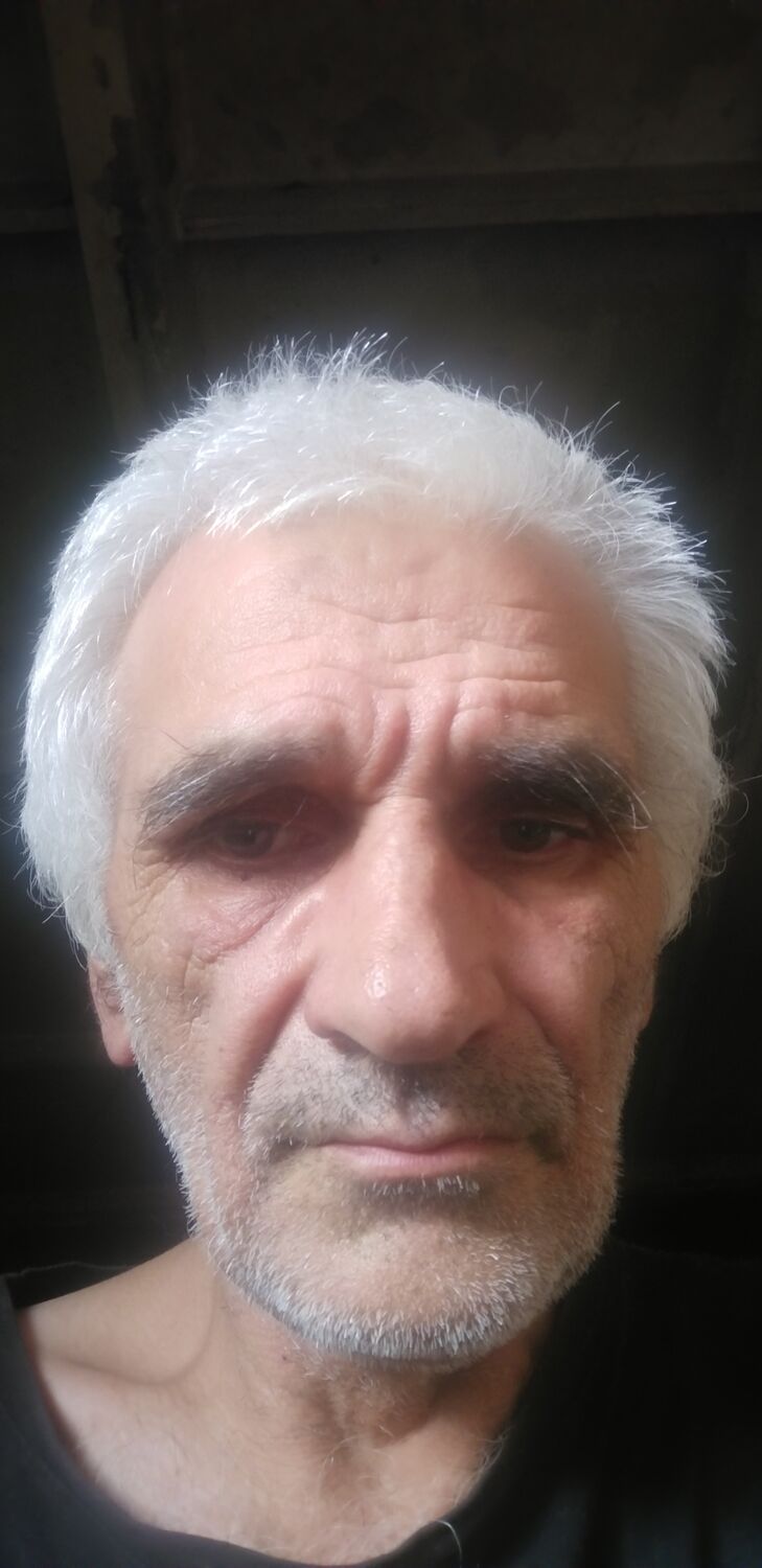  28028599  , 63 ,    