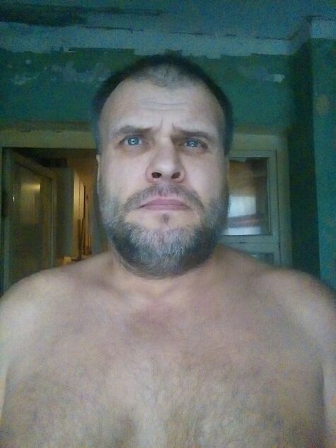  41984859  , 48 ,    
