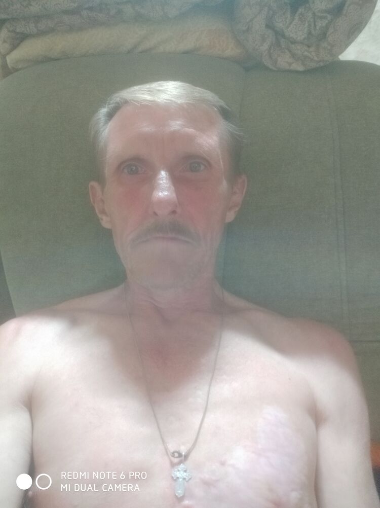  28550889  , 54 ,    