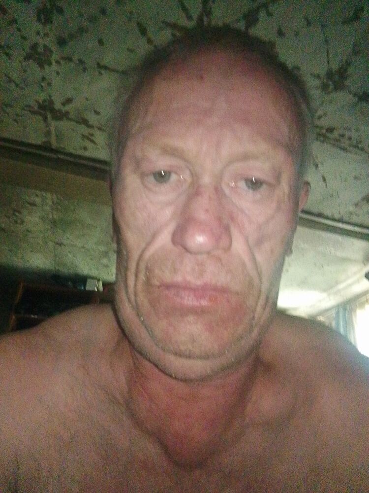  44183959  , 51 ,    