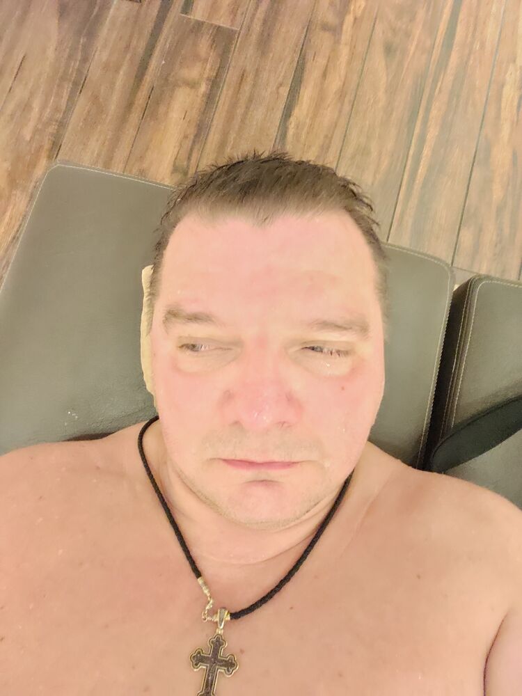  53179069  , 48 ,    