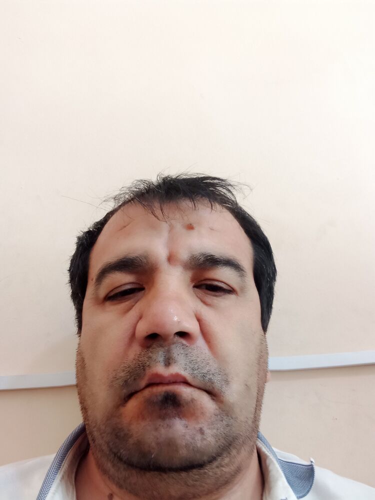  35238989  , 44 ,    