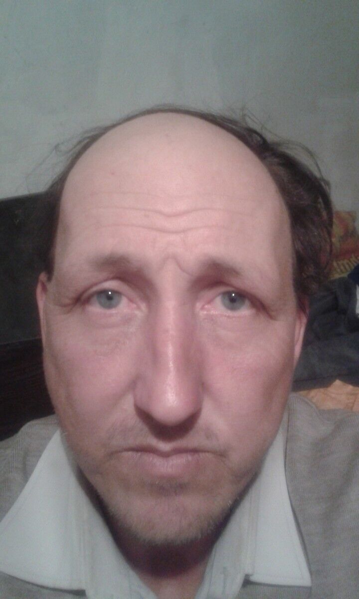  16113369  Valera, 49 ,    