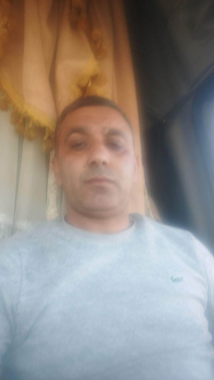  47095569  , 38 ,    