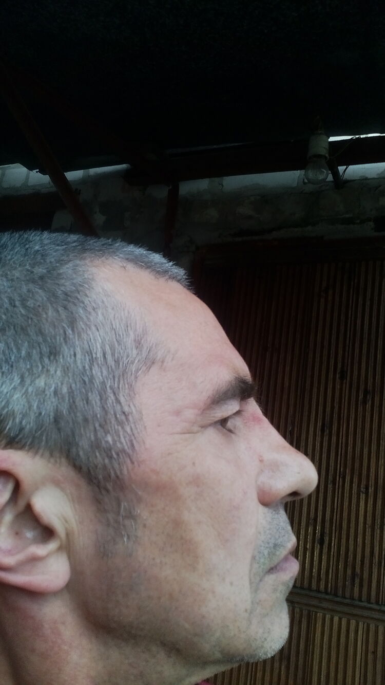  22718219  , 61 ,    