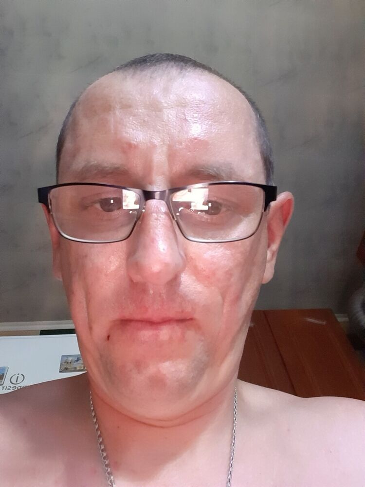  20386559  , 43 ,    
