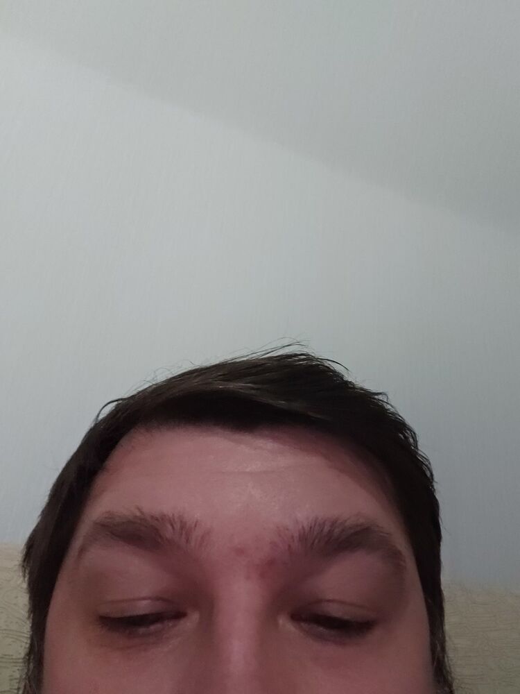  18645029  , 48 ,    