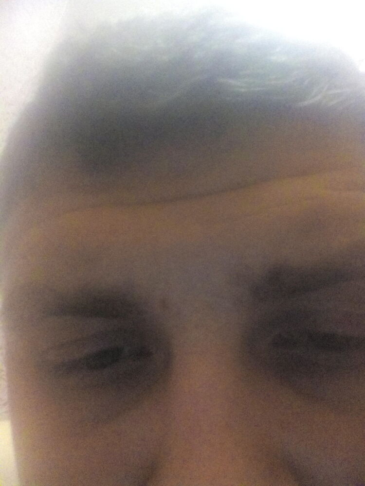  8824629  , 35 ,    
