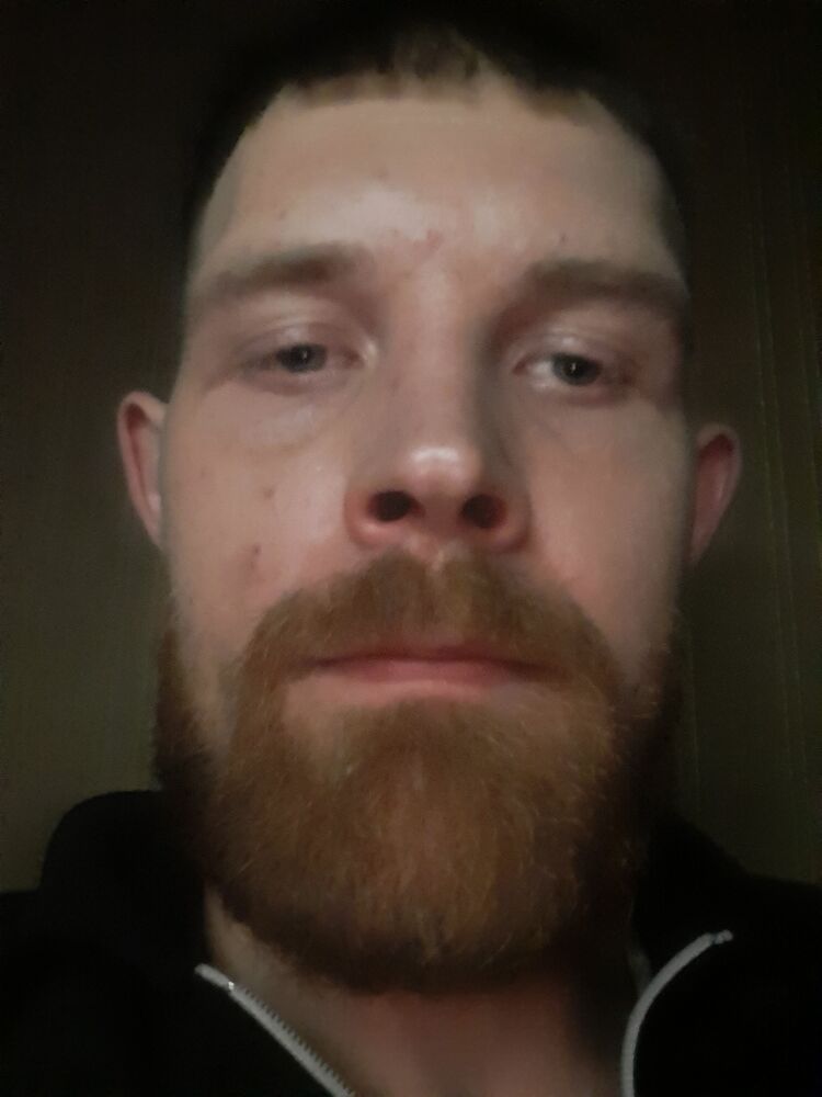  32355429  , 32 ,    