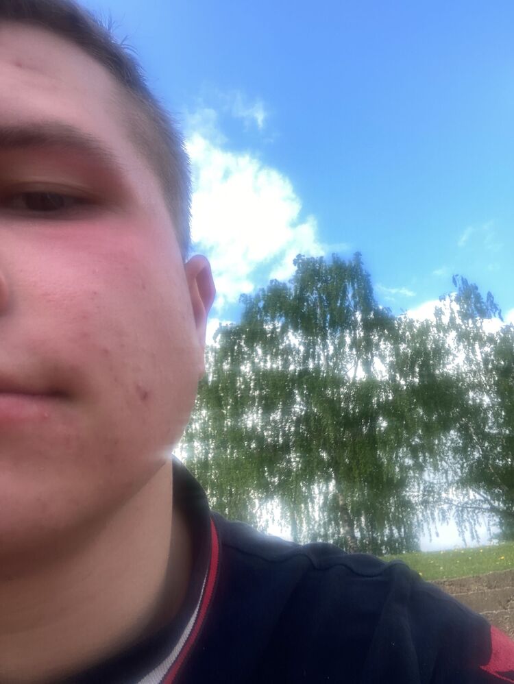  34825479  , 23 ,    