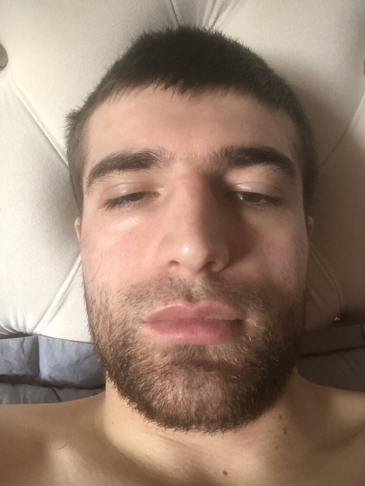  24936379  , 30 ,    