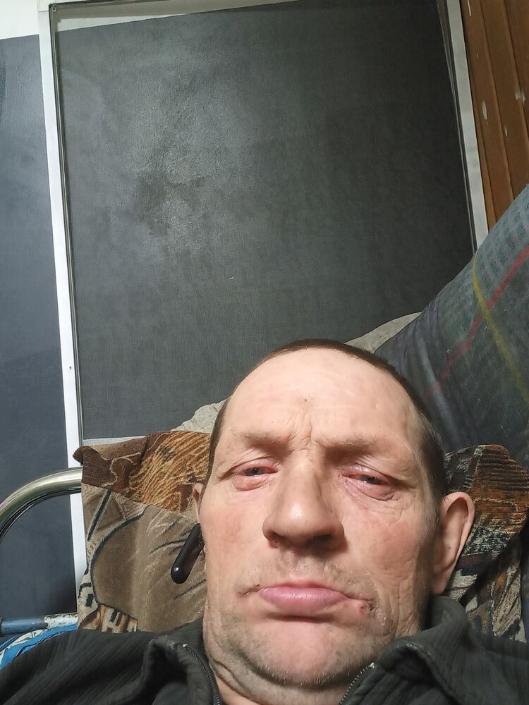  39790589  , 43 ,    