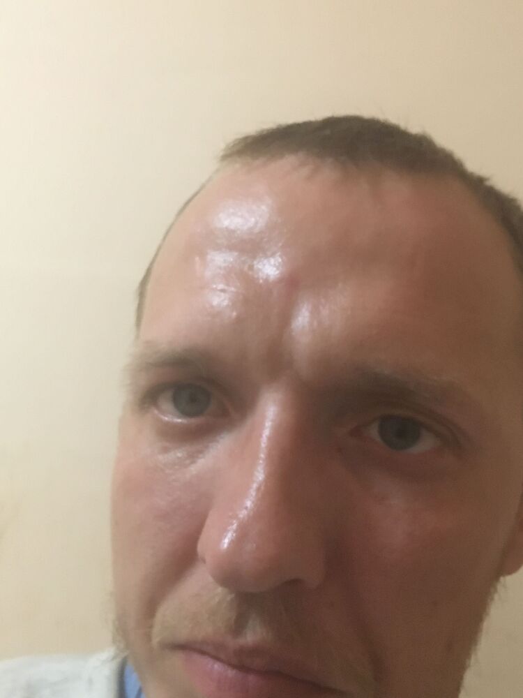  42266189  , 36 ,    