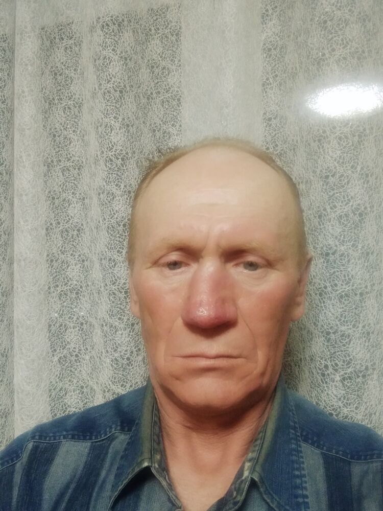  44581789  , 55 ,    