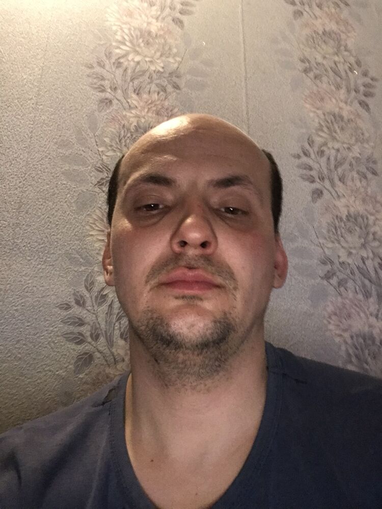  34607179  , 35 ,    