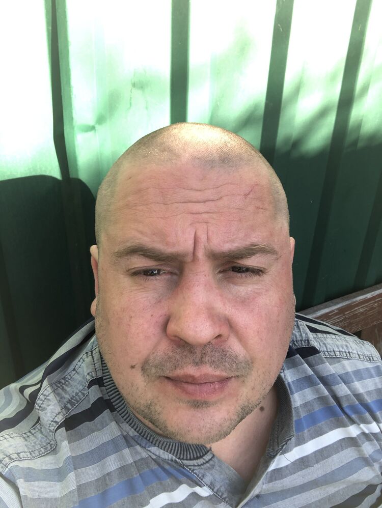  33557019  , 41 ,    
