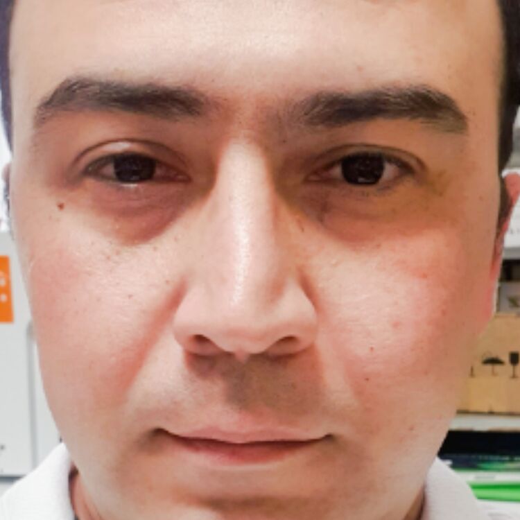 ���� 45019589 ������� ����, 35 ���, ���� ���������� � �������������