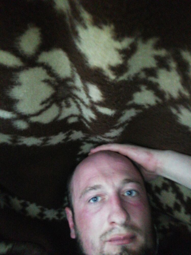 17808709  , 34 ,    