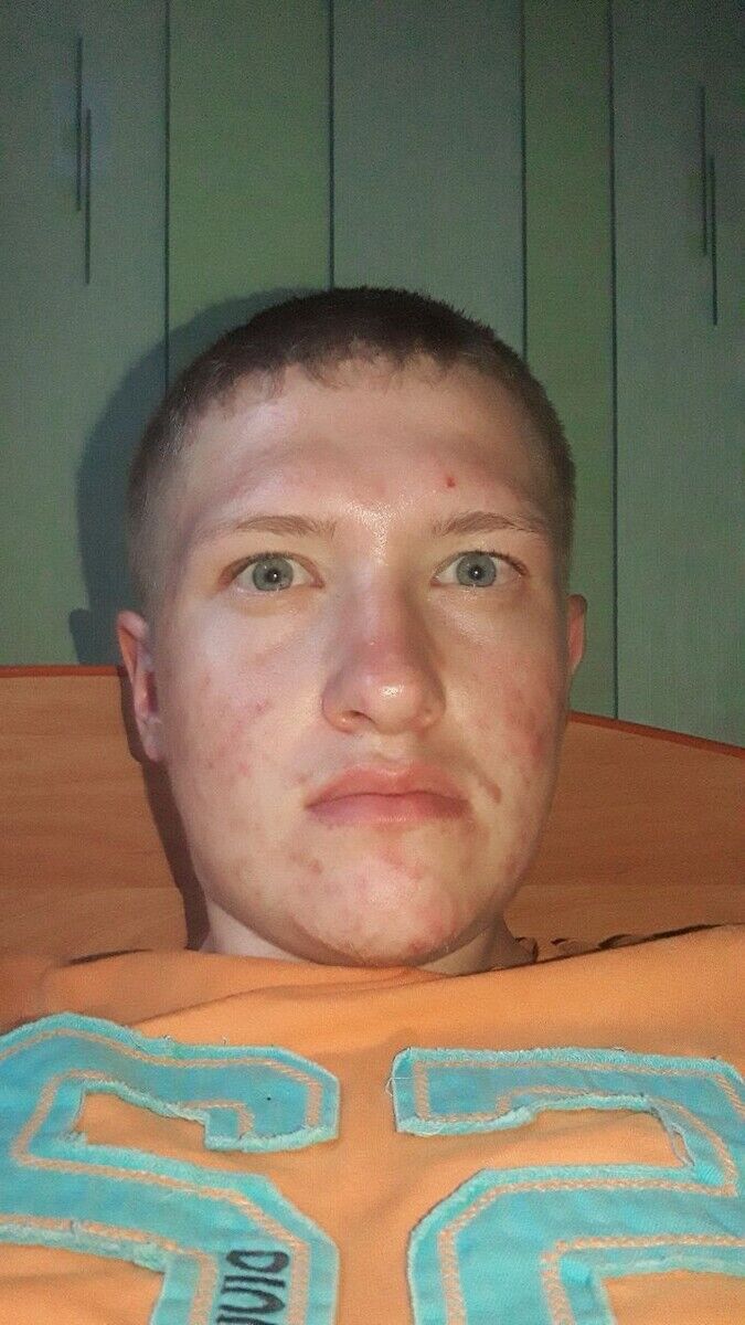  20283749  , 24 ,    