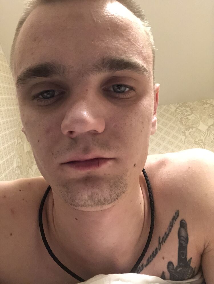  33661959  , 23 ,    