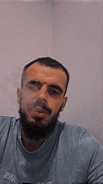  ,   Hamolli, 37 ,   ,   