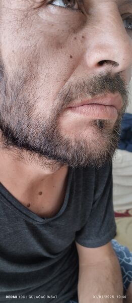  Etimesgut,   Yasar, 38 ,   ,   